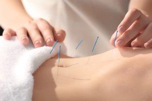 Acupunctura si secretele medicinei traditionale chineze